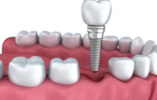 Introduction to the dentistry of the Second Affiliated Hospital of Kunming Medical University