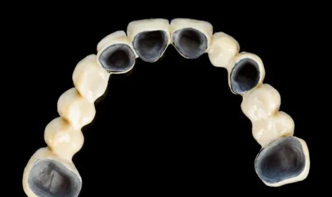 Zhengzhou Oral Implant Specialist Hospital Recommended [7 Good Reputation]