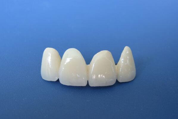 Which hospital is good for dental implants in Changzhou? Experts give strength reviews and price lists