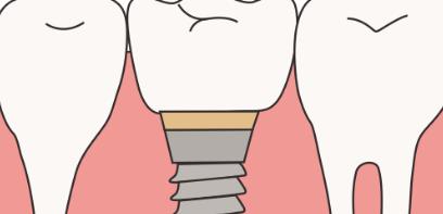 【Focus】The list of 10 popular dental hospitals in Chongqing was announced, and the ultra-high attention detonated the market!