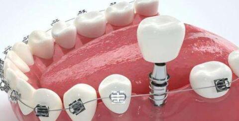 Yantai high-quality dental hospital ranking announced! Orthodontic specialist German and Korean dentistry is on the list!