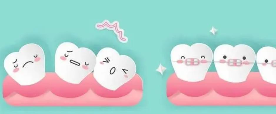The list of the best dental hospitals in Zhongshan in 2024 is announced! Word-of-mouth oral Xiangshan strength won the championship!