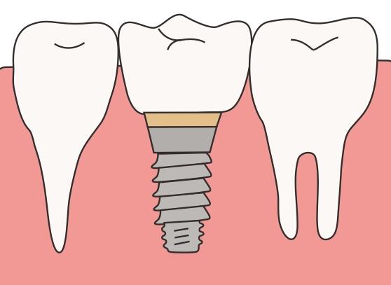 What is the efficacy of the Department of Orthodontics of Beijing 301 Hospital? Recommended by these two patients! Analysis of the unique treatment methods of experts