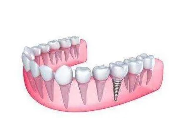 Shijiazhuang is affordable and excellent dental medical recommendation? Detailed prices at a glance 2024