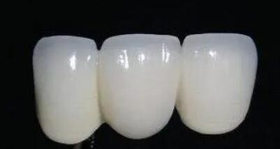 Which dental hospital in Shijiazhuang is good at dental implants? Introduction of five authoritative dental hospitals of municipal hospitals and provincial hospitals