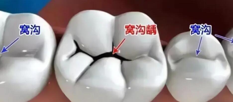 The latest ranking of Harbin dental implant hospitals is released, see if there is a hospital you like!