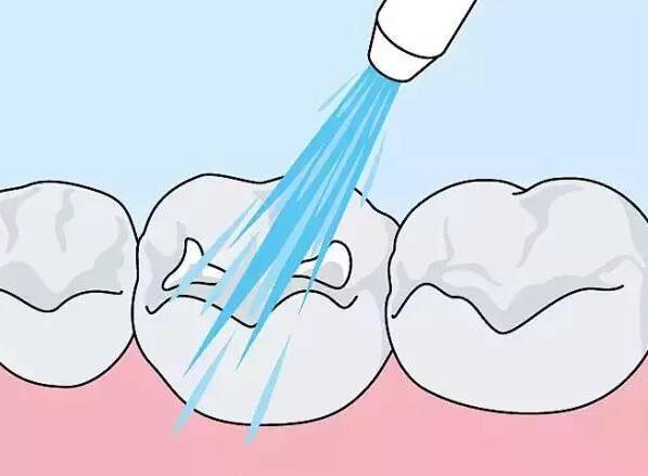 Which medical institution in Jinhua is worth choosing dental implants? Learn about the famous medical institutions of dental implants in Jinhua City