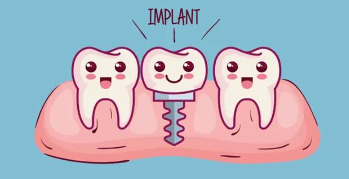 Foshan Oral Implant Dental Hospital TOP8, come and learn about the price list of Foshan Dental Project!