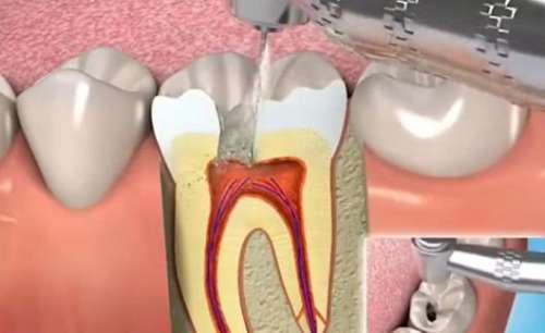 The more popular dental hospital in Lanzhou City, the technical strength is far ahead!