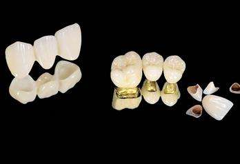 Analysis of the cost of Foshan's top dental implant hospitals, famous doctors share with real cases!