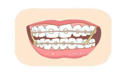 Which hospital has better dental implant results in Nanjing? The city's ** dental hospital and Meiao Dental are good choices, in addition to 3 worth recommending!
