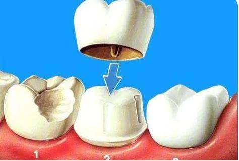 The latest release of Quanzhou Dental Hospital Ranking! Weile Dental Hospital and Zhijie Dental are worth paying attention to!