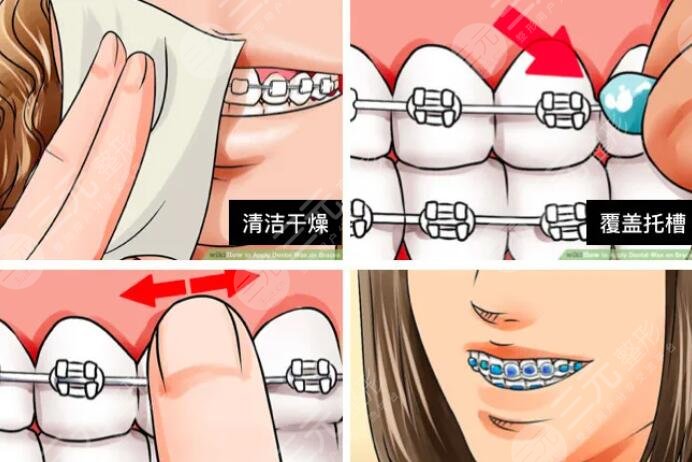 What tests are required before orthodontic treatment?