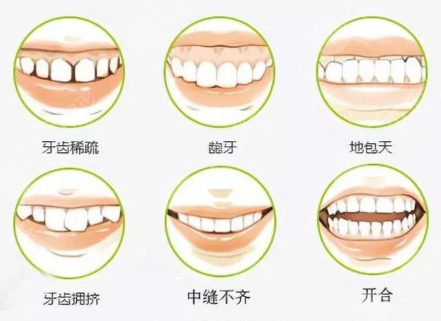Orthodontic case of Chengdu Second People's Hospital