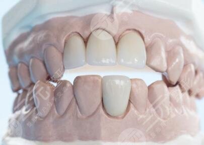Foshan Yadu Dental Hospital orthodontic case sharing