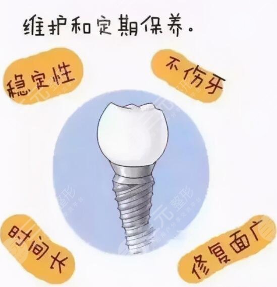 What are the advantages of dental implants?