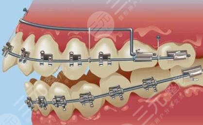 Who is orthodontic suitable for?
