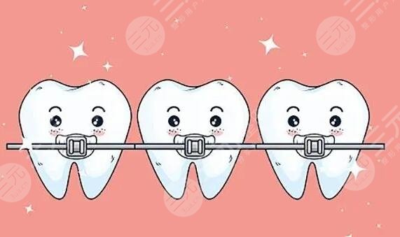 Orthodontic case of Beijing Boai Dental Hospital