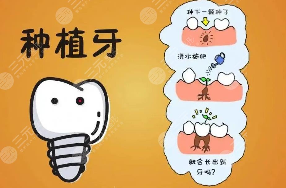 Dental implants