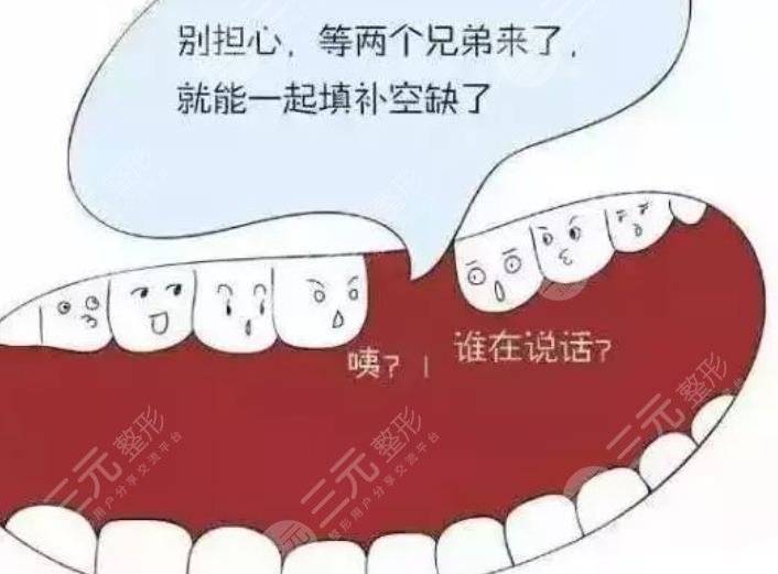 Dental implants
