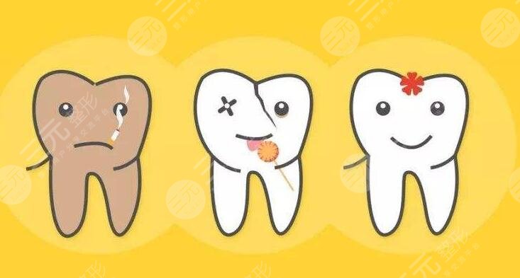 Teeth whitening