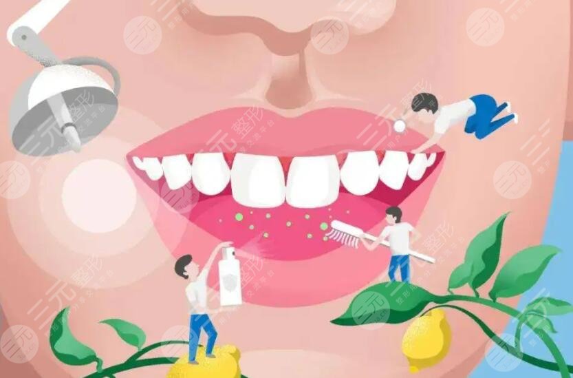 Teeth whitening
