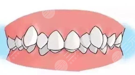 Orthodontics