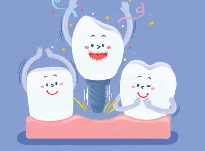 Dental implants