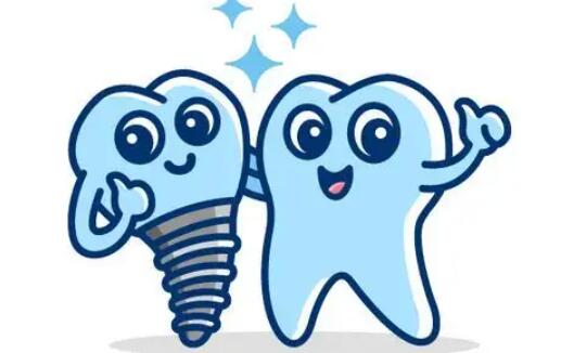 Dental implants