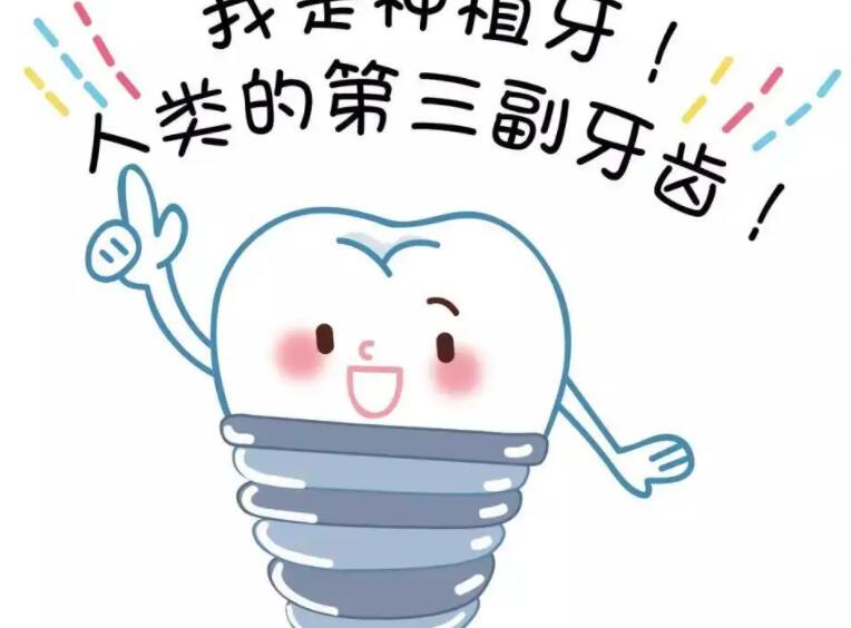 Dental implants