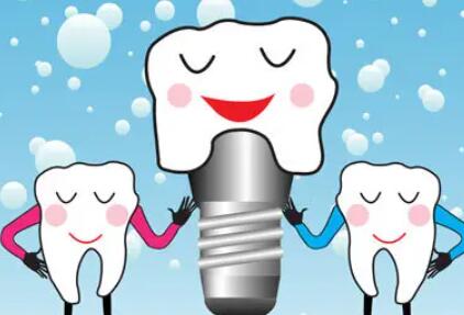 Dental implants