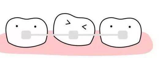 Orthodontics