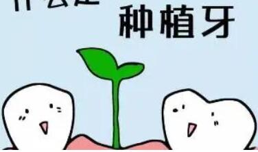 Dental implants