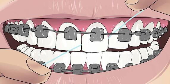 What are the influencing factors for the cost of dental visits?