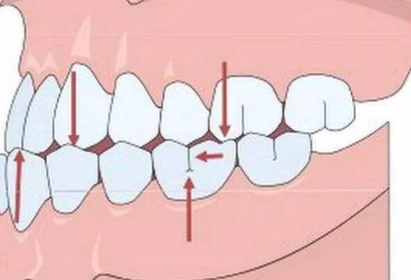 Orthodontics