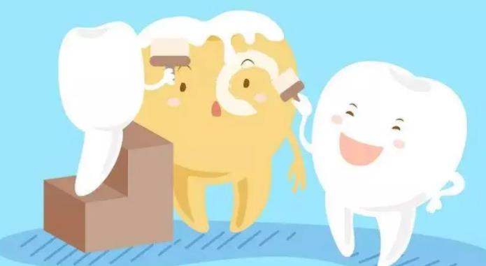 Teeth whitening